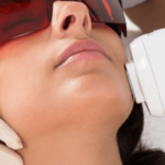 إزالة الشعر في المنزل بالليزر