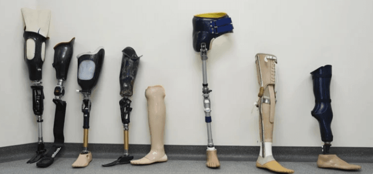 أسعار الأطراف الصناعية في السعودية